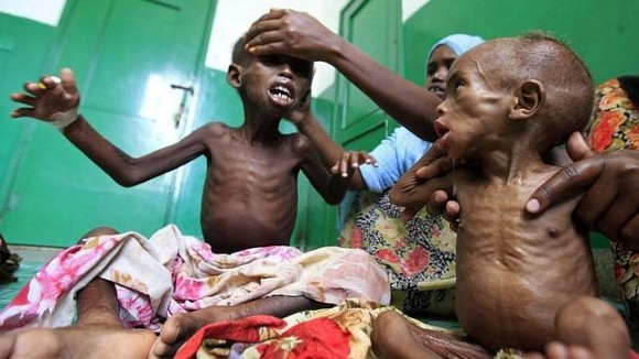 Niños hambrientos somalíes cuidados en un hospital de Mogadiscio. Foto: Reuters